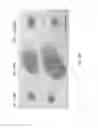 Fig. 06 - ADMINISTRATION OF AN ANTI-ACTIVIN-A COMPOUND TO A SUBJECT