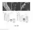 Fig. 17 - Methods of treating vestibular schwannoma and reducing hearing or neurite loss caused by vestibular schwannoma