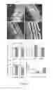 Fig. 22 - Methods of treating vestibular schwannoma and reducing hearing or neurite loss caused by vestibular schwannoma