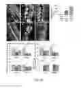 Fig. 26 - Methods of treating vestibular schwannoma and reducing hearing or neurite loss caused by vestibular schwannoma
