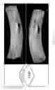 Fig. 06 - Methods and compositions for bone formation