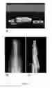 Fig. 07 - Methods and compositions for bone formation