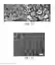 Fig. 11 - Methods and compositions for bone formation