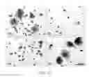 Fig. 14 - Methods and compositions for bone formation