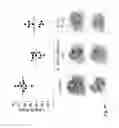 Fig. 60 - IL-15R ALPHA FORMS, CELLS EXPRESSING IL-15R ALPHA FORMS, AND THERAPEUTIC USES OF IL-15R ALPHA AND IL-15/IL-15R ALPHA COMPLEXES