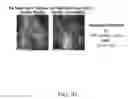 Fig. 04 - INSULIN RECEPTOR INDUCED ELASTIN PRODUCTION