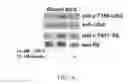Fig. 15 - INSULIN RECEPTOR INDUCED ELASTIN PRODUCTION