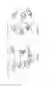 Fig. 04 - Matrix composed of a naturally-occurring protein backbone cross linked by a synthetic polymer and methods of generating and using same