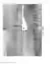 Fig. 20 - Matrix composed of a naturally-occurring protein backbone cross linked by a synthetic polymer and methods of generating and using same