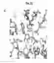Fig. 13 - Compositions and methods for treating pathological calcification and ossification