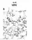 Fig. 17 - Compositions and methods for treating pathological calcification and ossification