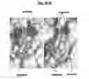 Fig. 19 - Compositions and methods for treating pathological calcification and ossification
