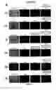 Fig. 08 - Compositions and Methods for Treating Complications Associated with Diabetes
