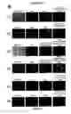 Fig. 09 - Compositions and Methods for Treating Complications Associated with Diabetes
