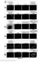 Fig. 10 - Compositions and Methods for Treating Complications Associated with Diabetes