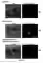 Fig. 14 - Compositions and Methods for Treating Complications Associated with Diabetes