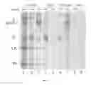 Fig. 05 - Viral Vaccine Vectors