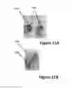 Fig. 20 - Methods for local drug delivery by microinjection array