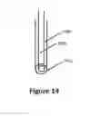 Fig. 24 - Methods for local drug delivery by microinjection array
