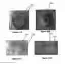 Fig. 32 - Methods for local drug delivery by microinjection array
