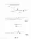 Fig. 09 - Lipids, lipid complexes and use thereof