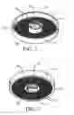 Fig. 02 - Polyp Filter