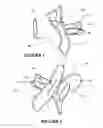 Fig. 02 - Mouthpiece