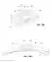 Fig. 45 - Patient interface systems