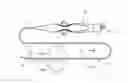Fig. 01 - Triple coil catheter support
