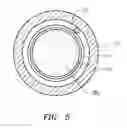 Fig. 06 - Triple coil catheter support