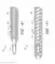 Fig. 04 - Over-the-needle expandable catheter