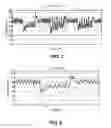 Fig. 02 - Methods and systems for controlling blood pressure by controlling atrial pressure