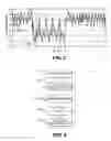 Fig. 06 - Methods and systems for controlling blood pressure by controlling atrial pressure
