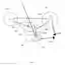 Fig. 76 - OPTOGENETIC THERAPIES FOR MOVEMENT DISORDERS