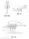Fig. 72 - OPTOGENETIC THERAPIES FOR MOVEMENT DISORDERS