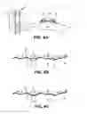 Fig. 05 - Active electroadhesive cleaning