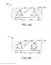 Fig. 08 - Methods and systems for integrally trapping a glass insert in a metal bezel