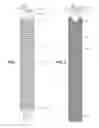 Fig. 02 - Filing Tool Attachment for a Reciprocating Tool
