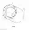 Fig. 02 - Bonnet Nut Socket