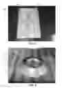 Fig. 04 - System and Method of Forming Machined Surface Finish On Polycarbonate Material