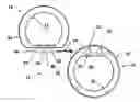 Fig. 01 - Closure with Hinged Lid