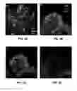 Fig. 09 - Growth matrices for stem cell propagation in vitro and in tissue regeneration