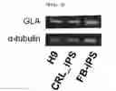 Fig. 07 - Induced pluripotent stem cell model for Fabry disease and use thereof