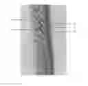 Fig. 01 - Paper guide rope