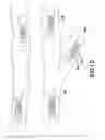 Fig. 09 - Wireless communication and telemetry for completions