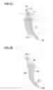 Fig. 06 - Turbine rotor blade