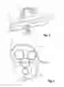 Fig. 02 - Device for securing and retaining at least one electrical harness in a turbomachine