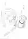 Fig. 16 - Combination C-shaped spring and system