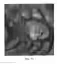 Fig. 74 - Trimmer head with pivoting posts