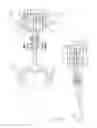 Fig. 04 - Meat processing equipment having improved yieldable arresting means